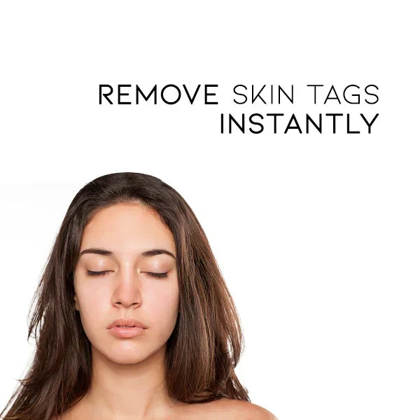 Spray para eliminar verrugas: cuidado suave y eficaz